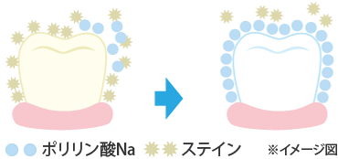 ホワイトニングをしながら歯をコーティング