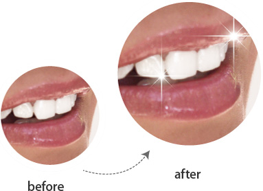 ポリリンプラチナホワイトニングのbefore・after