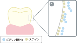 歯の表面に付着したステイン（茶シブやたばこのヤニなど）に近づくと